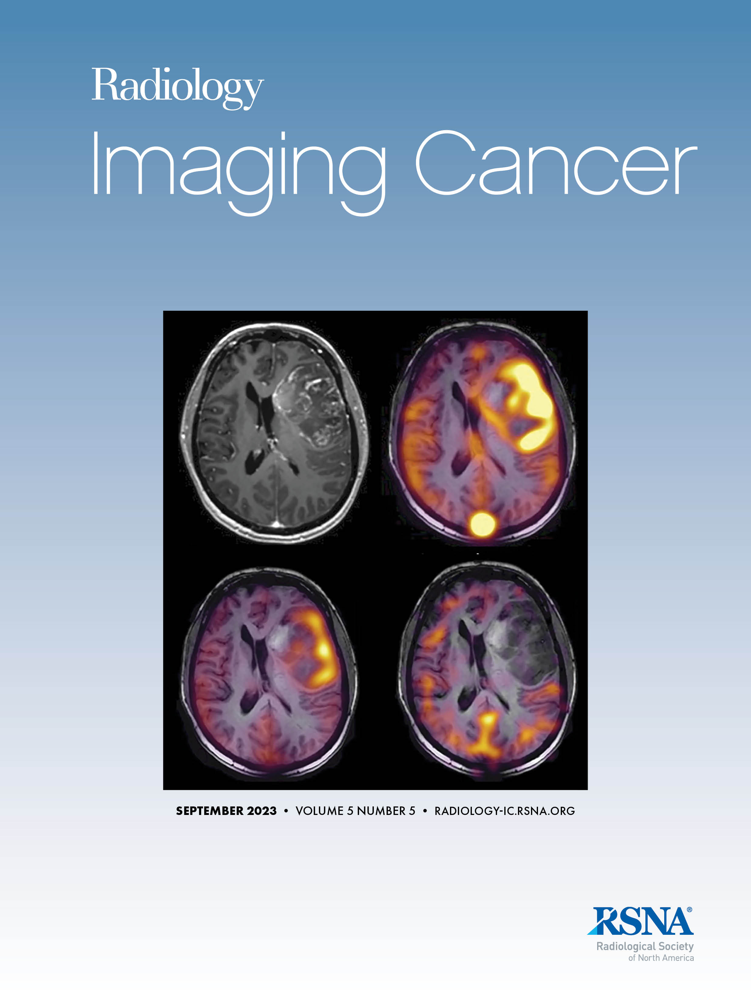 Radiology-imaging Cancer